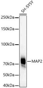 MAP2 Antibody in Western Blot (WB)