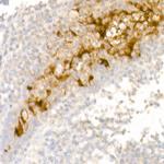 Mesothelin Antibody in Immunohistochemistry (Paraffin) (IHC (P))