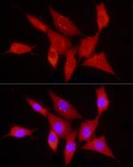 PDGF-B Antibody in Immunocytochemistry (ICC/IF)