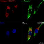 COL1A1 Antibody in Immunocytochemistry (ICC/IF)