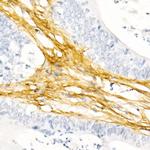 COL1A1 Antibody in Immunohistochemistry (Paraffin) (IHC (P))