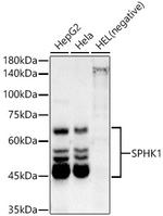 SPHK1 Antibody in Western Blot (WB)