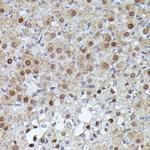 PFKFB3 Antibody in Immunohistochemistry (Paraffin) (IHC (P))