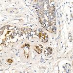 MMP7 Antibody in Immunohistochemistry (Paraffin) (IHC (P))