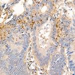 MMP7 Antibody in Immunohistochemistry (Paraffin) (IHC (P))