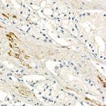 MMP7 Antibody in Immunohistochemistry (Paraffin) (IHC (P))