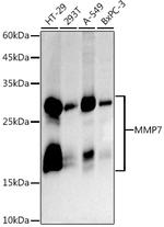 MMP7 Antibody in Western Blot (WB)