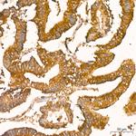 NFkB p65 Antibody in Immunohistochemistry (Paraffin) (IHC (P))