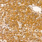 NFkB p65 Antibody in Immunohistochemistry (Paraffin) (IHC (P))