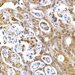 SOCS1 Antibody in Immunohistochemistry (Paraffin) (IHC (P))