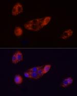 ADFP Antibody in Immunocytochemistry (ICC/IF)