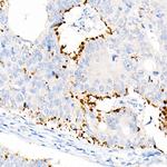 ADFP Antibody in Immunohistochemistry (Paraffin) (IHC (P))