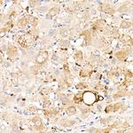 ADFP Antibody in Immunohistochemistry (Paraffin) (IHC (P))