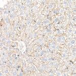 ADFP Antibody in Immunohistochemistry (Paraffin) (IHC (P))