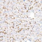 ADFP Antibody in Immunohistochemistry (Paraffin) (IHC (P))