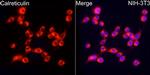 Calreticulin Antibody in Immunocytochemistry (ICC/IF)