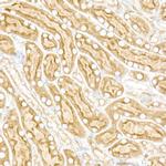 Calreticulin Antibody in Immunohistochemistry (Paraffin) (IHC (P))