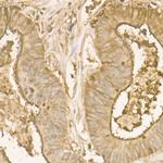 CEA Antibody in Immunohistochemistry (Paraffin) (IHC (P))