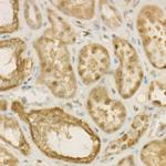 ATP Citrate Lyase Antibody in Immunohistochemistry (Paraffin) (IHC (P))