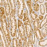 NDUFS1 Antibody in Immunohistochemistry (Paraffin) (IHC (P))