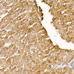 NDUFS1 Antibody in Immunohistochemistry (Paraffin) (IHC (P))