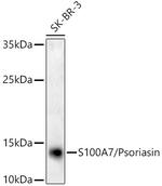 S100A7 Antibody in Western Blot (WB)