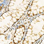 IP6K1 Antibody in Immunohistochemistry (Paraffin) (IHC (P))