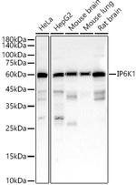 IP6K1 Antibody in Western Blot (WB)