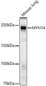 MYH14 Antibody in Western Blot (WB)