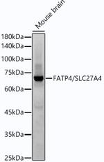 SLC27A4 Antibody in Western Blot (WB)