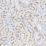 HNF1A Antibody in Immunohistochemistry (Paraffin) (IHC (P))