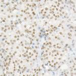 HNF1A Antibody in Immunohistochemistry (Paraffin) (IHC (P))