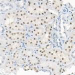 HNF1A Antibody in Immunohistochemistry (Paraffin) (IHC (P))