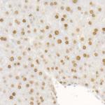 DNA Ligase III Antibody in Immunohistochemistry (Paraffin) (IHC (P))