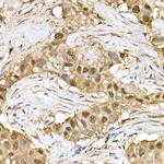 ERK1/ERK2 Antibody in Immunohistochemistry (Paraffin) (IHC (P))