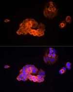 MMP13 Antibody in Immunocytochemistry (ICC/IF)