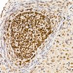 DNMT1 Antibody in Immunohistochemistry (Paraffin) (IHC (P))