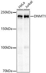 DNMT1 Antibody in Western Blot (WB)