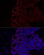 ADFP Antibody in Immunocytochemistry (ICC/IF)