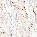 ADFP Antibody in Immunohistochemistry (Paraffin) (IHC (P))