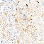 ADFP Antibody in Immunohistochemistry (Paraffin) (IHC (P))