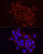 SDHC Antibody in Immunocytochemistry (ICC/IF)