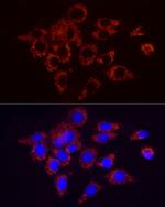 SDHC Antibody in Immunocytochemistry (ICC/IF)