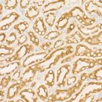 SDHC Antibody in Immunohistochemistry (Paraffin) (IHC (P))