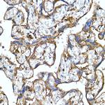 Folate Receptor alpha Antibody in Immunohistochemistry (Paraffin) (IHC (P))