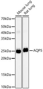 Aquaporin 5 Antibody in Western Blot (WB)