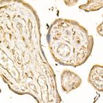 TGFBR2 Antibody in Immunohistochemistry (Paraffin) (IHC (P))