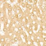 STIM1 Antibody in Immunohistochemistry (Paraffin) (IHC (P))