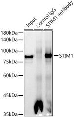 STIM1 Antibody in Immunoprecipitation (IP)