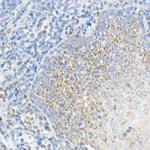 NDUFS3 Antibody in Immunohistochemistry (Paraffin) (IHC (P))